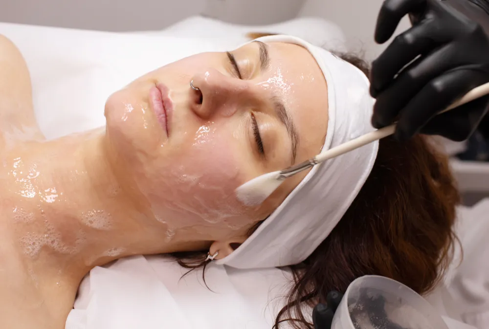 Chemical peel