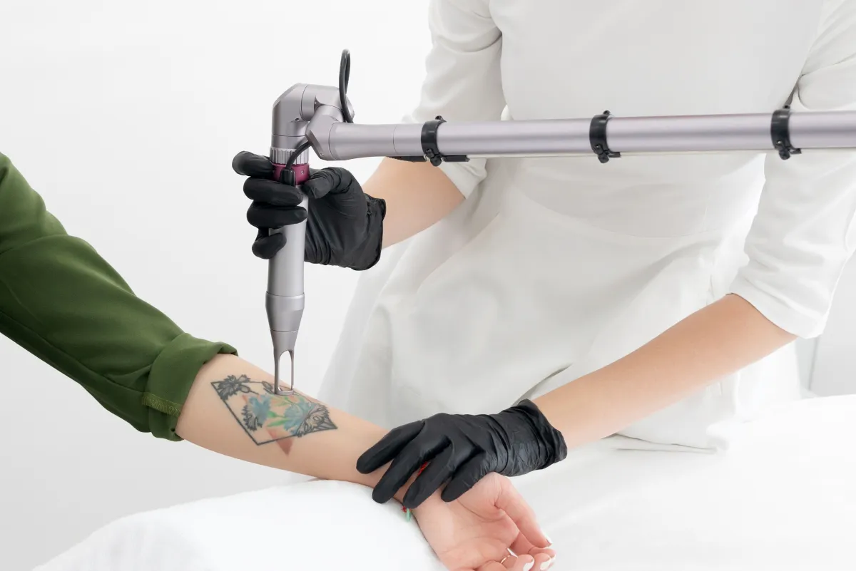 Laser Birthmark and Tattoo Removal