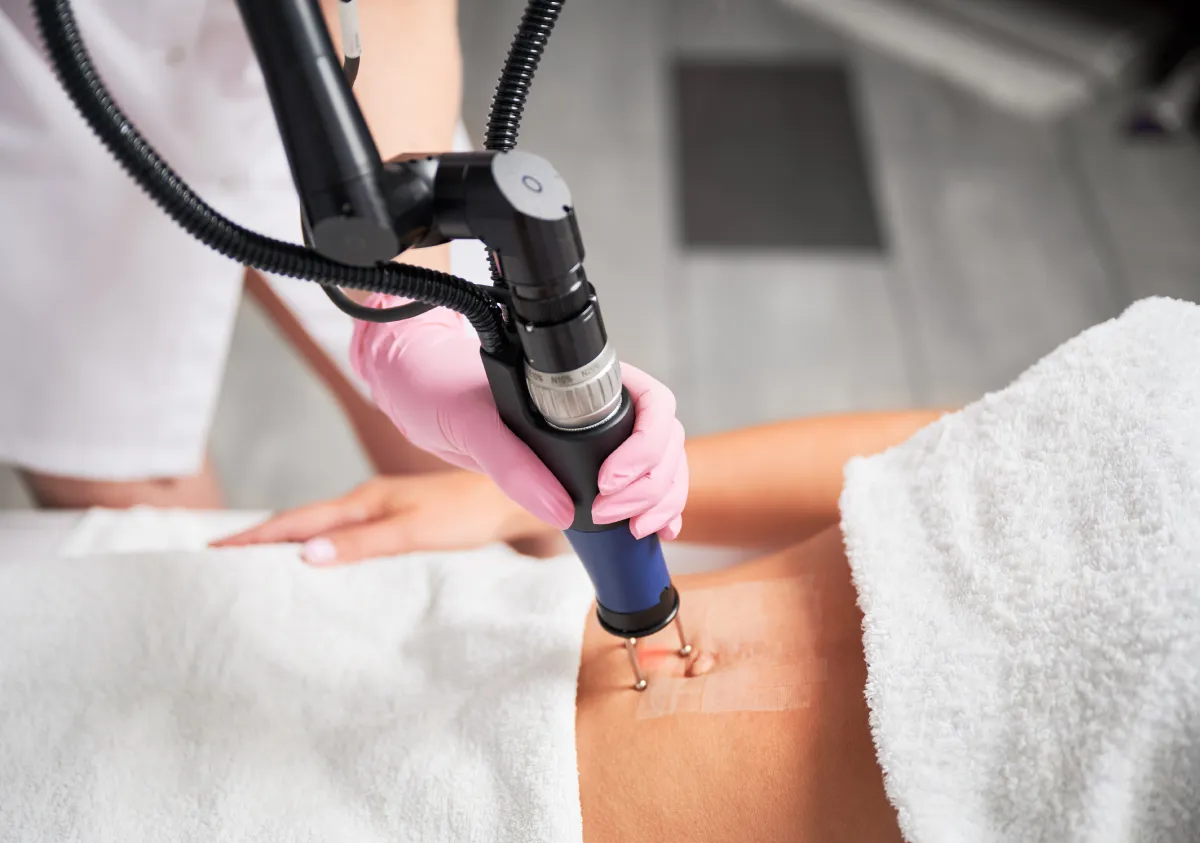 Scar removal
