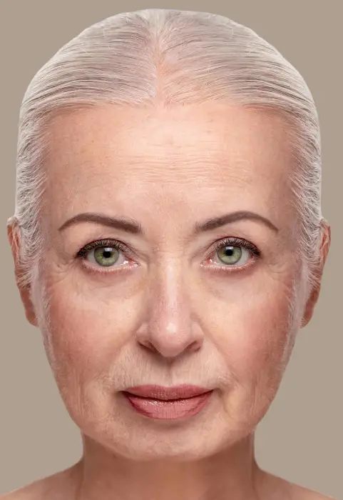 Laser Scar ,Warts,Moles,Stretch Marks & Wrinkles Removal before