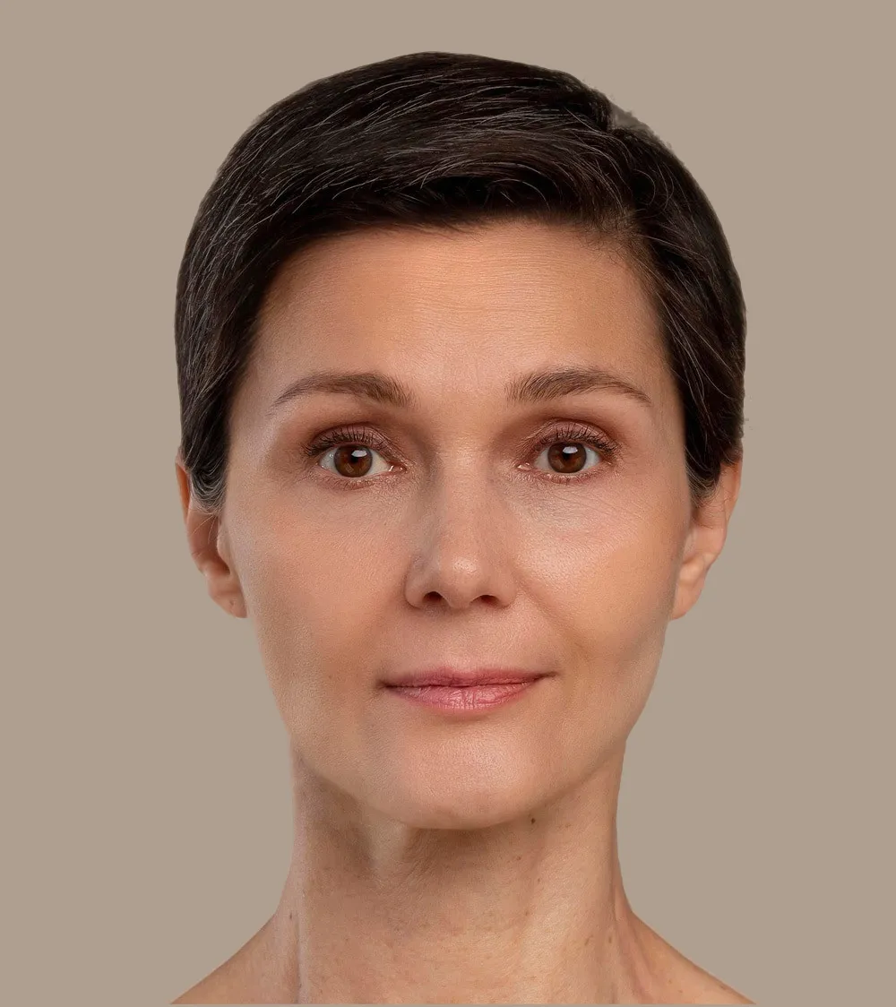 after-botox-treatment