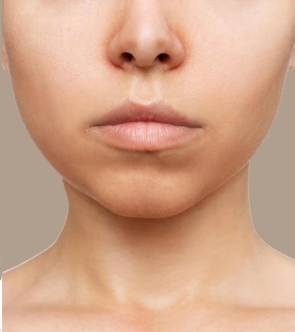 after-double-chin-reduction